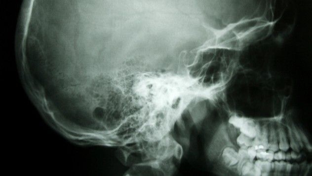 xray