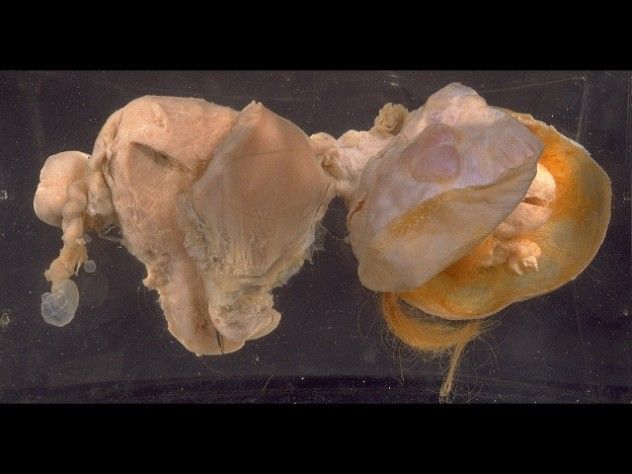 ovary