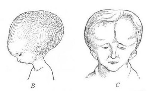 Melon-Heads