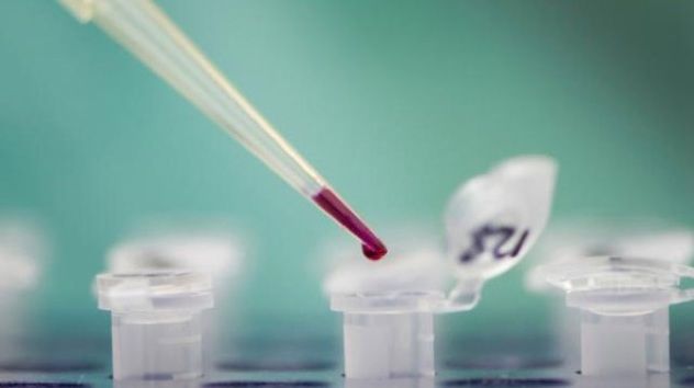 Blood-Test--Lab-File-Jpg