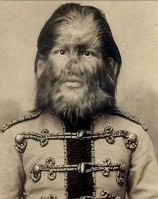 Russiandogfacedboy1