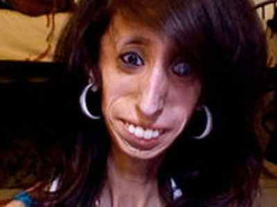 Lizzie-Velasquez-512 370X278