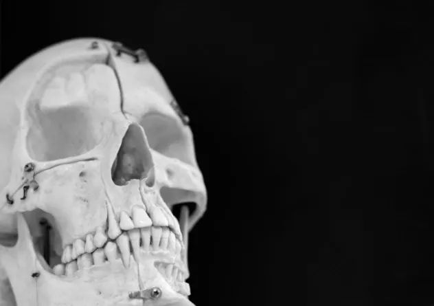 Skull