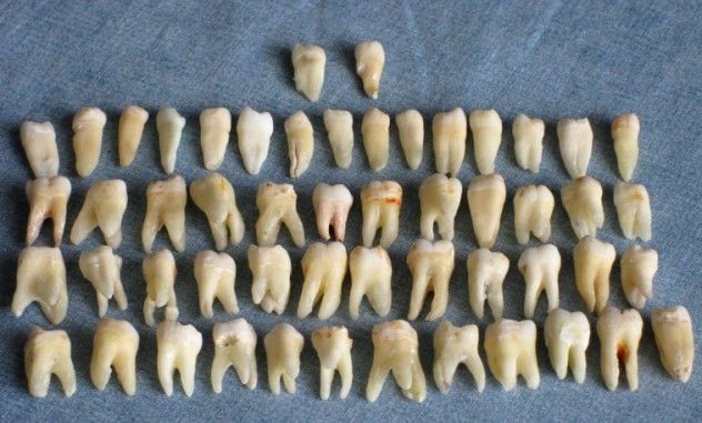 human_teeth