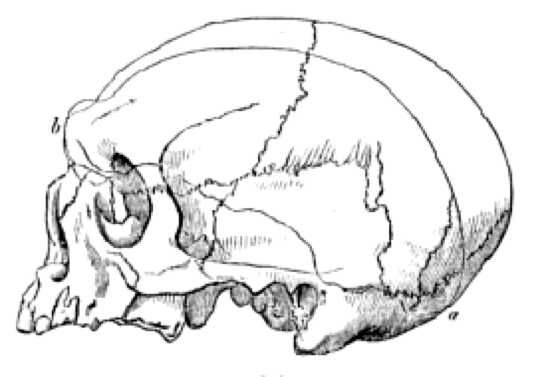 Image2