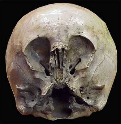 Starchild Skull-Alien-Surfer-Jerry