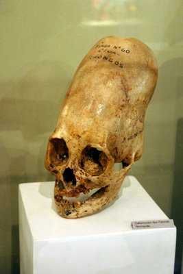 Skull-1