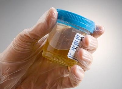 Testing Urine 2 445