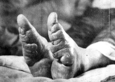 Boundfeet