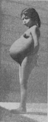 Lina Medina (1939)