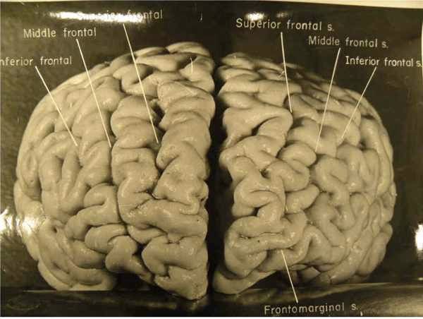 Fig05-Whole-Brain Custom-60Fc79F3Efbefb7Afd04350544B2Bb9C058Ef44B-S6-C10