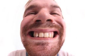 oversized teeth