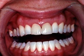 A man showing his teeth.