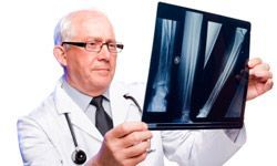 doctor examining x-ray of bones