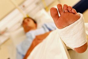 Man wearing a foot cast