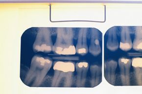 Dental x-ray imaging.