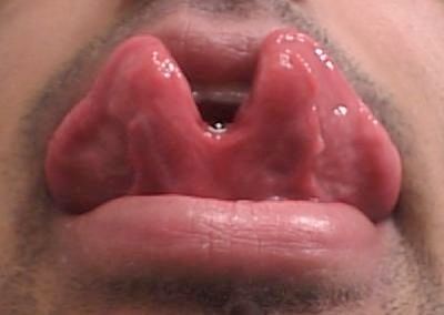 Tongue Split