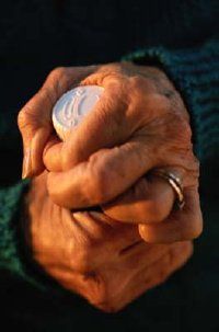 Individuals with rheumatoid arthritis often exhibit lower levels of pantothenic acid.