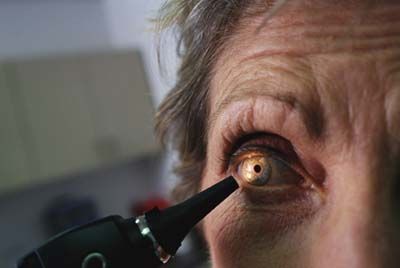 There is speculation that conditions like cataracts could be linked to insufficient riboflavin levels.