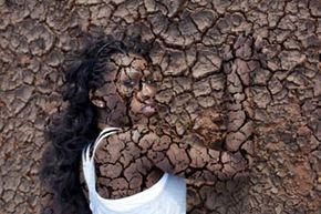 Image of a woman experiencing severe dry and cracked skin