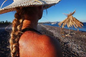 Just the sight of that fiery red sunburn can make you wince in pain.