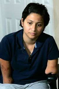 Claudia Mejia developed flesh-eating bacteria shortly before delivering her son. To save her life, she underwent multiple amputation surgeries.