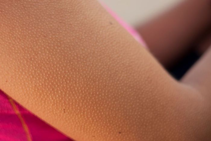 Goosebumps appearing on an arm