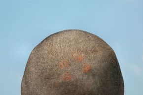 A closely trimmed hairstyle
