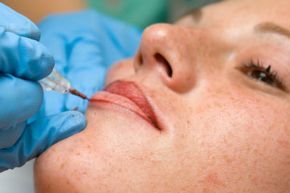 A woman enhances her lips with long-lasting color through a cosmetic procedure.
