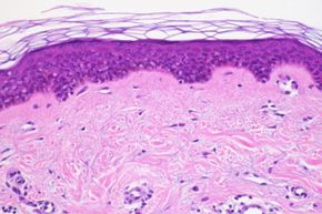 A microscopic view of normal human skin, stained with Hematoxylin and Eosin (H&E).