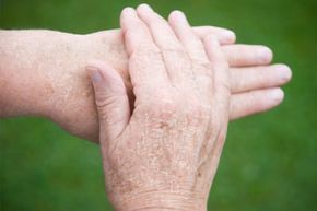 Close-up view of a 50-year-old Caucasian woman's hands.