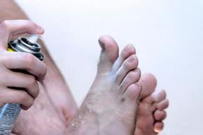 A man treating his fungal foot infection.