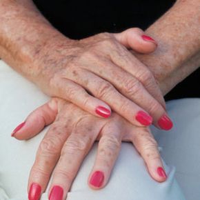 Close-up of an elderly woman's hands showing signs of aging.