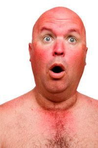 Man shocked by the severity of his sunburn.