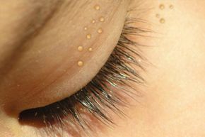 A detailed view of a child's closed eye
