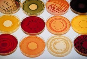 Various bacterial samples are cultivated in a laboratory at the pharmaceutical firm Aventis Pasteur.