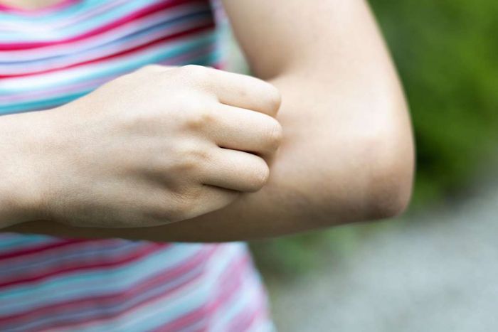 A photo of a woman scratching her arm