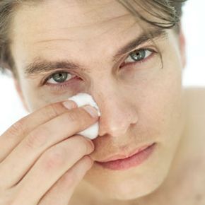 A young man experiencing puffiness under his eyes.