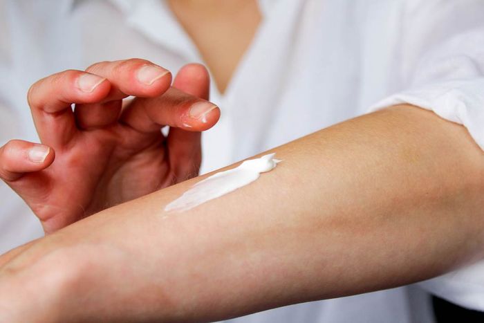 A woman gently applying soothing lotion to an insect bite on her arm