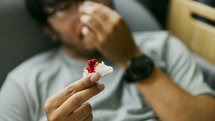 A man using one hand to hold a blood-stained tissue while attempting to stop his nosebleed with the other.