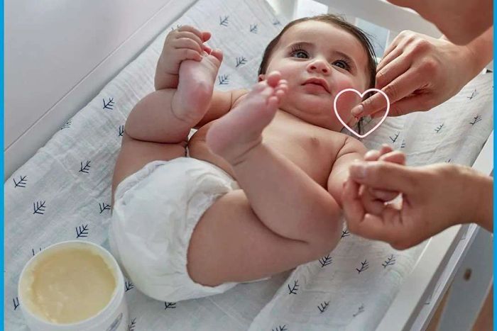 Best eczema solution for babies: Aquaphor Baby