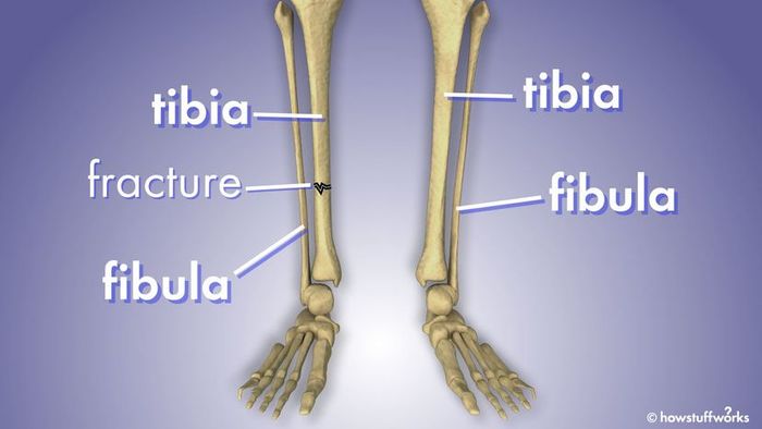 tibia and fibula