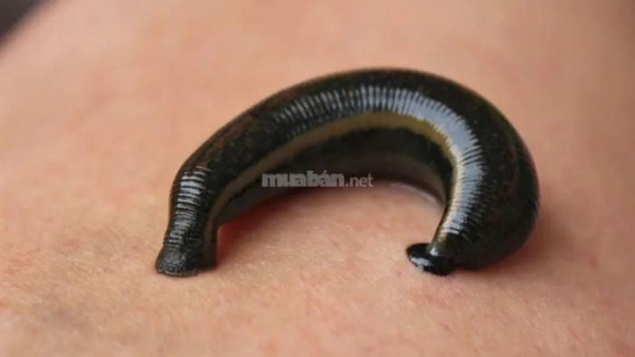 Giấc mơ thấy đỉa chui vào mũi được xem là một điềm báo tốt lành