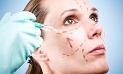 a woman undergoing a facelift procedure