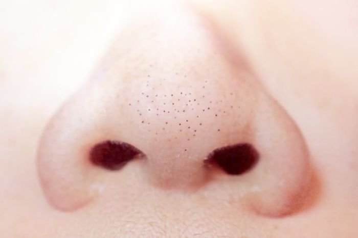 Blackheads on a nose