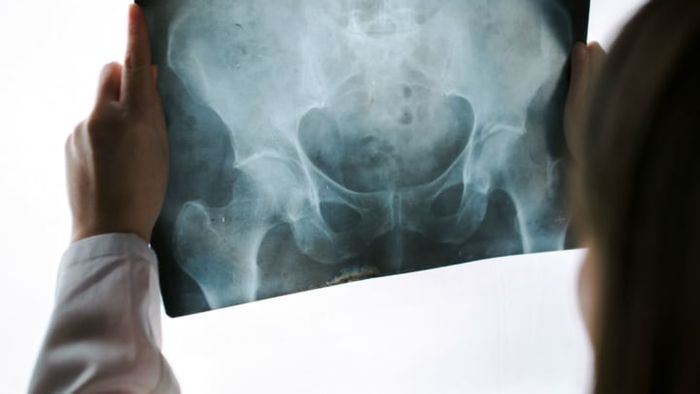 iStock