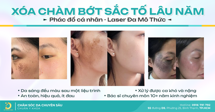 dia chi uy tin va an toan de xoa cham bot bam sinh tai TPHCM 2.png