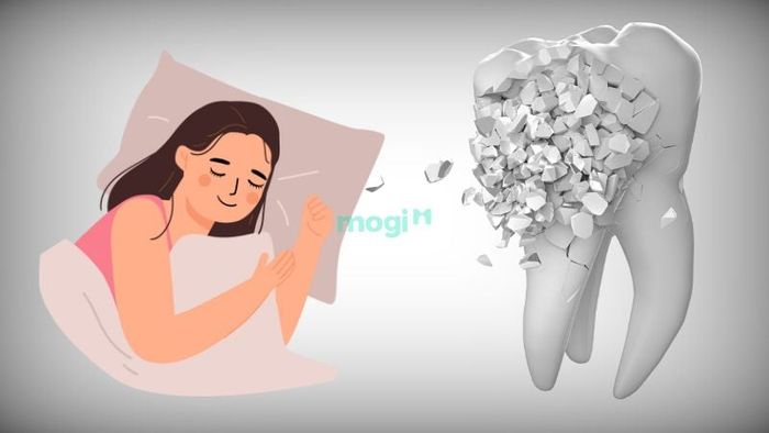 Mơ thấy răng bị gãy và vỡ thành nhiều mảnh