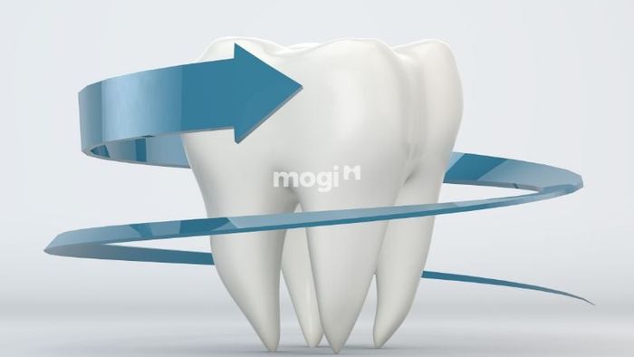 Tại sao lại mơ thấy mình bị gãy răng?