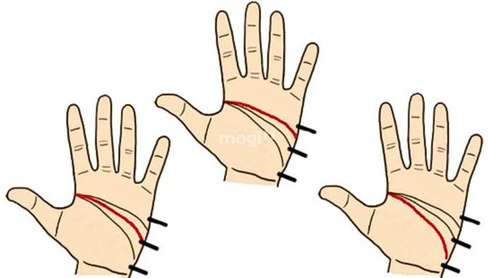 Vị trí của đường trí đạo trên lòng bàn tay